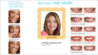 Atlantic Dental Healthcare - Snap-On Smile